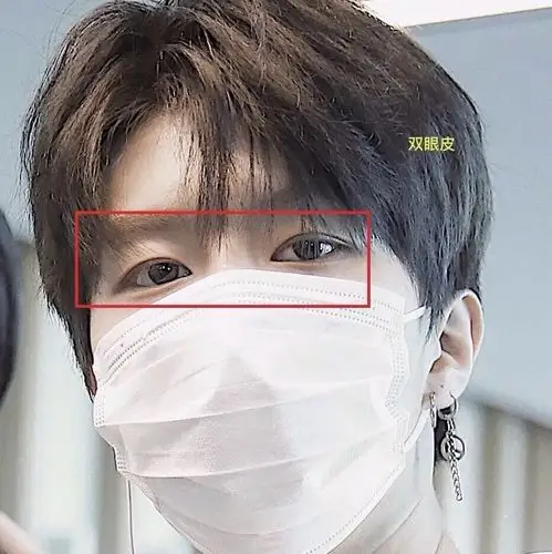 范丞丞为什么出道前后变化这么大有没有整容过71