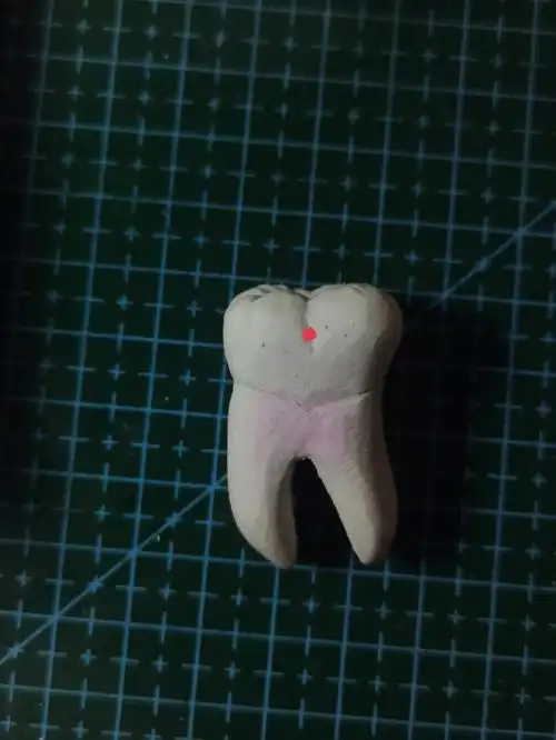 下六雕刻  #石膏牙  #下颌第六磨牙雕刻