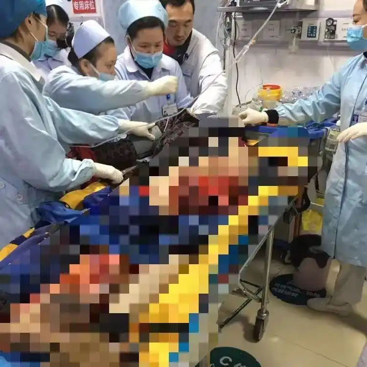 株洲男子被钢板砸到右下肢连同右侧半骨盆完全离断……现实版死神来了