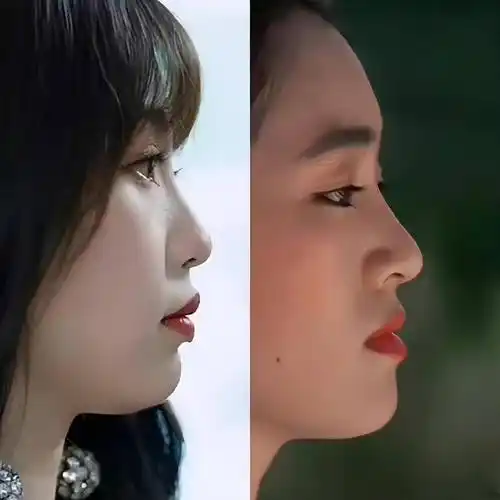 近镜头下,她的侧面五官不够立体,扁平的面颊及鼻子,导致她的嘴部凸出.