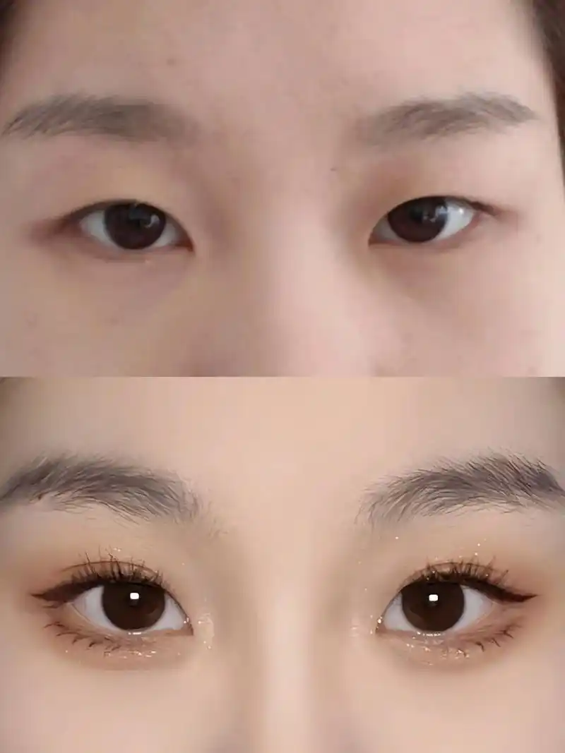 单眼皮保姆级双眼皮贴教程,新手进来抄作业.