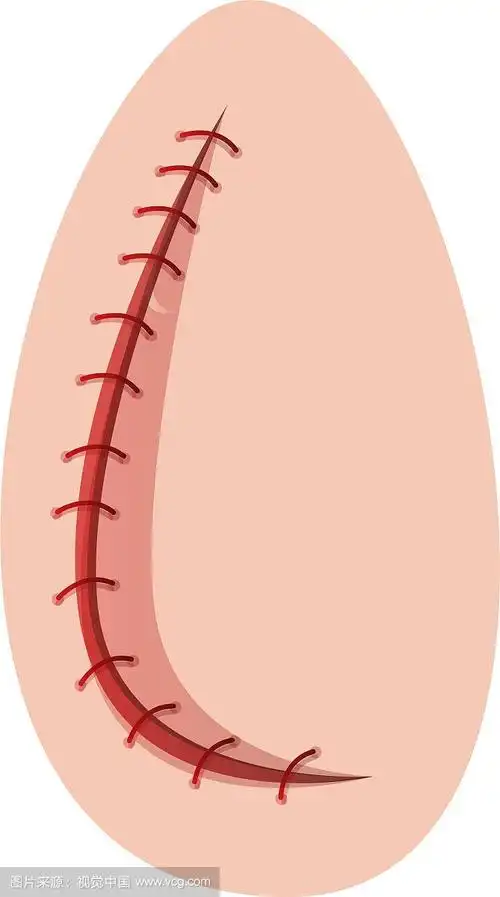 撕裂伤缝合图标卡通风格