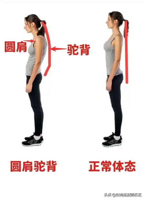 打扮再精致都没气质|驼背|好身材_网易订阅