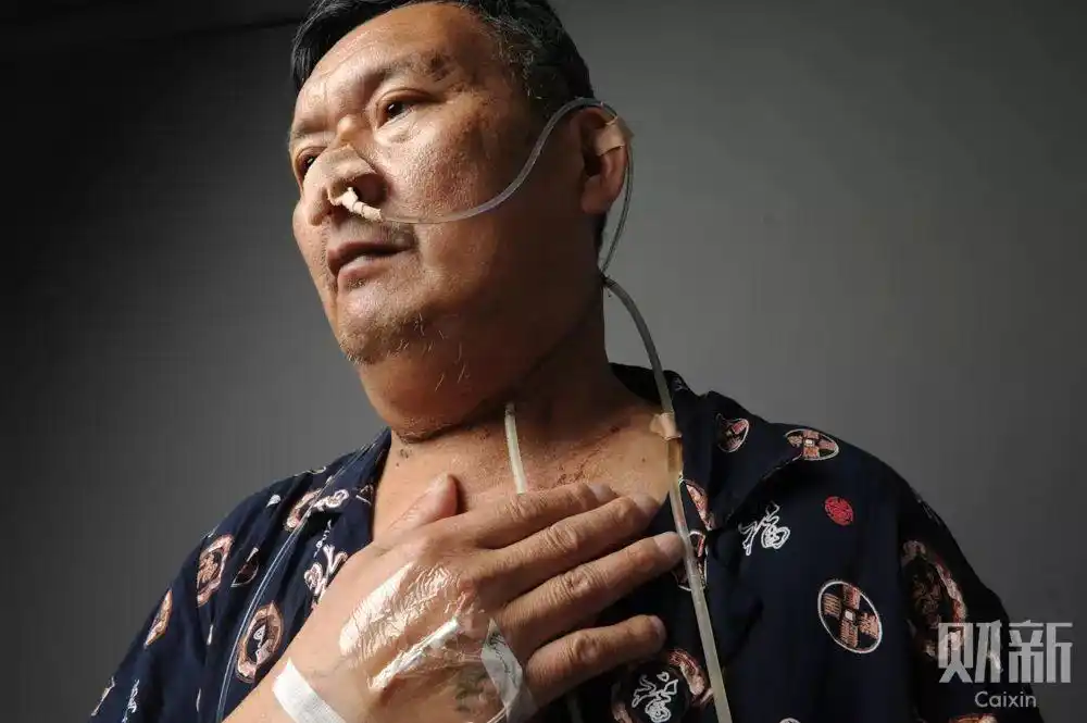 李水生出院前夕,医院正在给他拍摄医学影像建立档案,此后他需要定期来