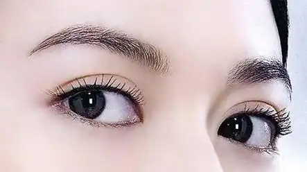 双眼皮最多可以做几次修复手术?