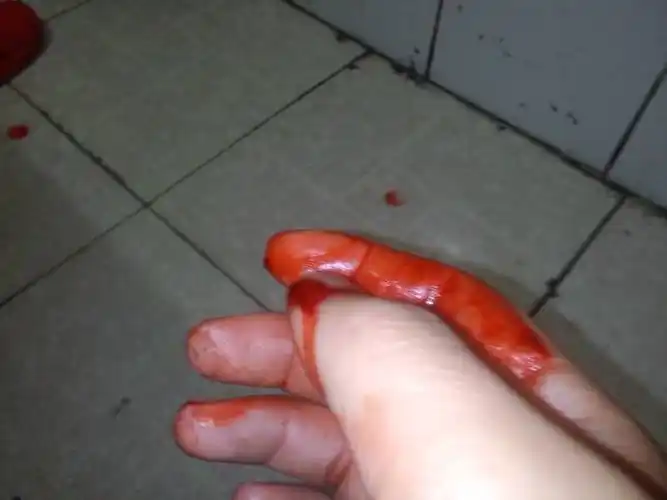 自己手受伤成这样了,他只是因为两人的嬉闹,过后就生气了,看见自己