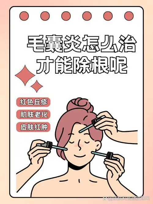 毛囊炎怎么治才能除根呢	  一,认识毛囊炎 毛囊炎就是毛囊被细菌感染