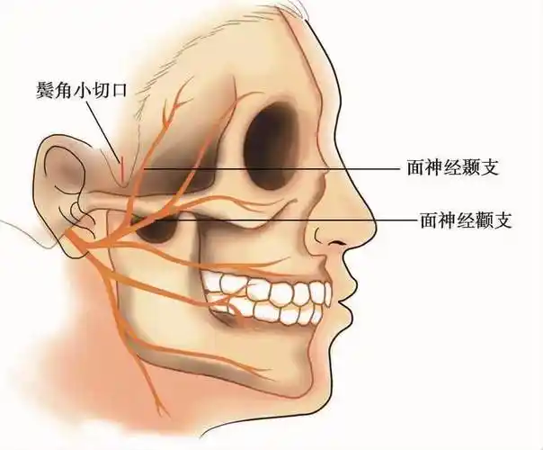 面神经分布.jpg