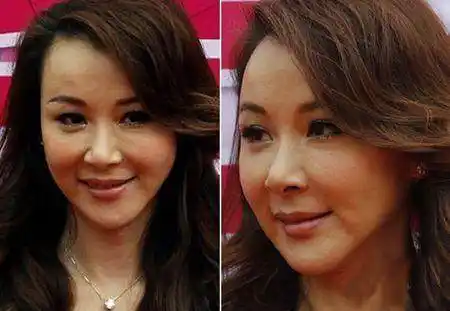 萧蔷或许是整容后遗症最明显的一个女明星了,还是自然老去,适当保养