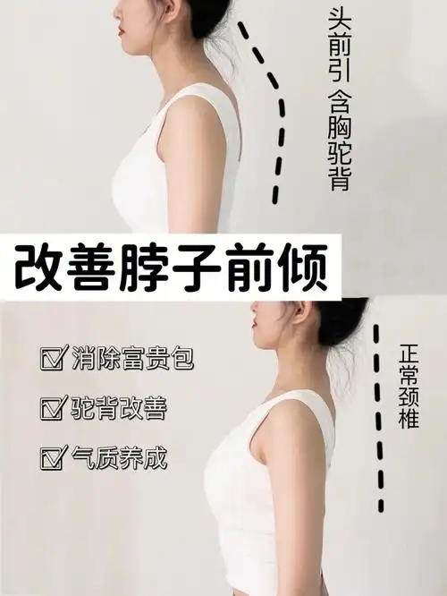 7个动作打造气质肩背改善脖子前倾富贵包73