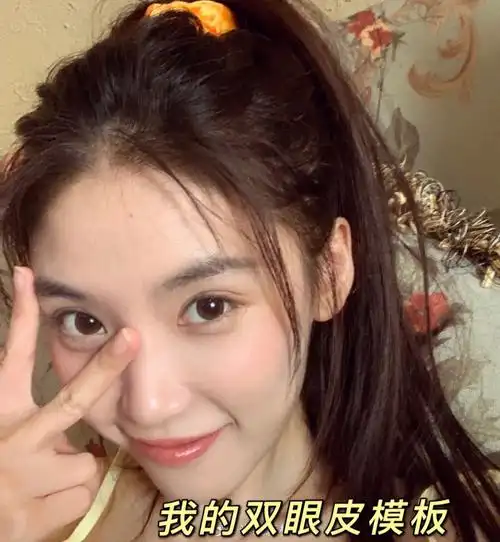 在成都花了6k做了半藏森林双眼皮