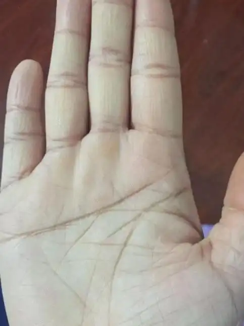 苦命一辈子的女人手相难享夫福没人疼怕要婚后遭抛弃