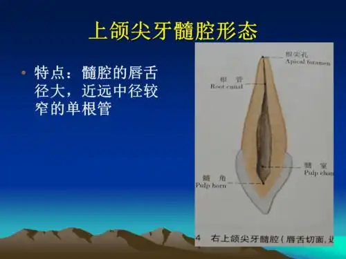 口腔解剖生理学尖牙的髓腔形态