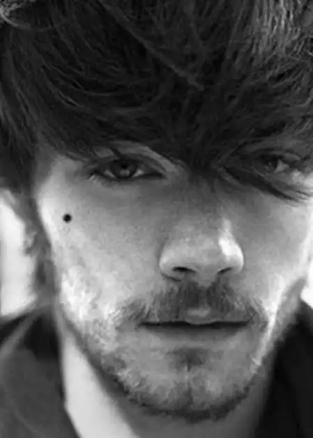 颧骨有痣.(图/人民网)