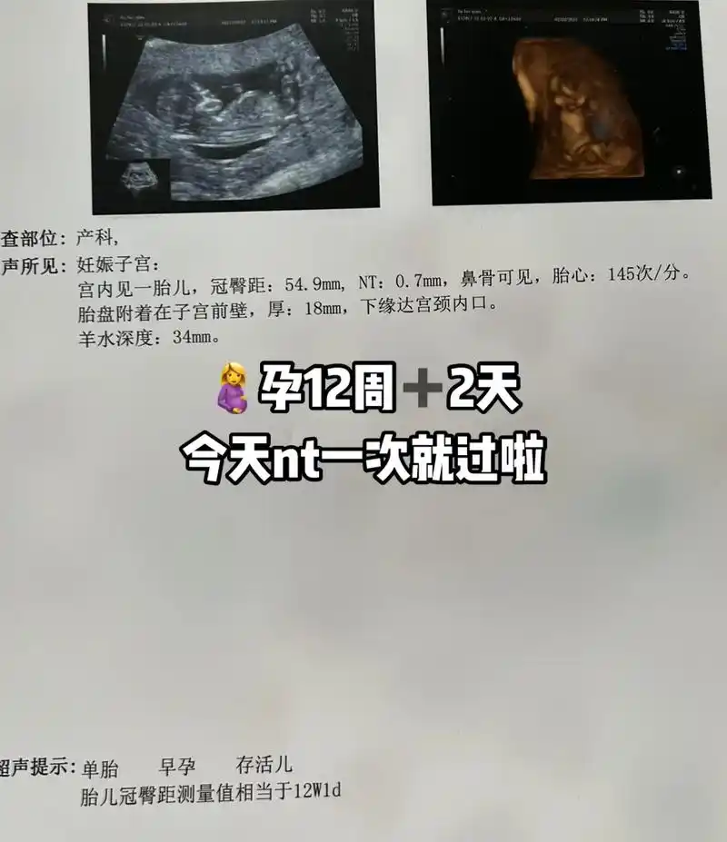 听说nt值小于1.5是女孩 - 抖音