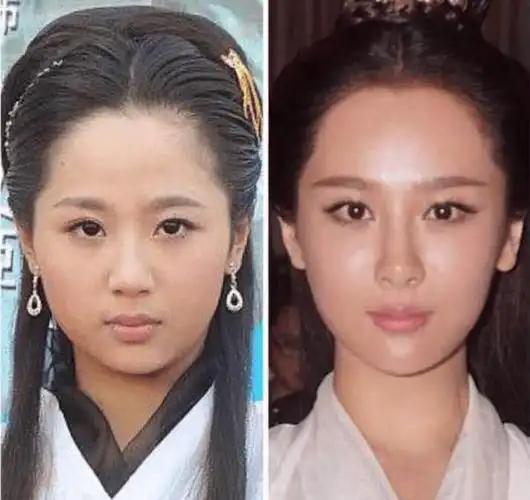 整形过的明星(整形上瘾的女明星)-百科学社