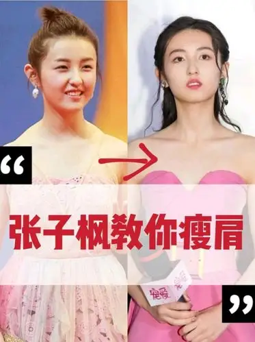 9999到底肩颈线对于体态问题有多大,看看张子枫从斜方_圈子-新氧