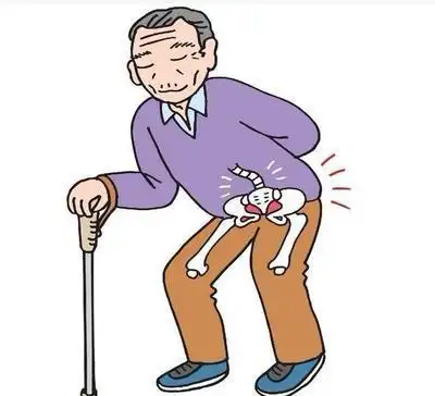 股骨头坏死自测标准,看看这些症状有没有?插图