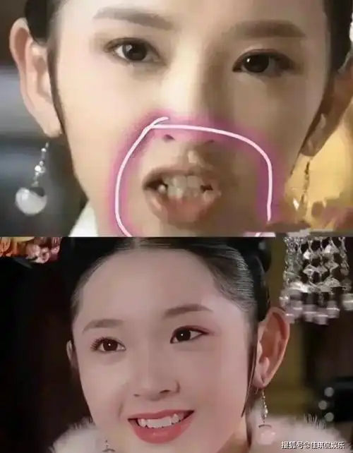 牙齿_明星_观众