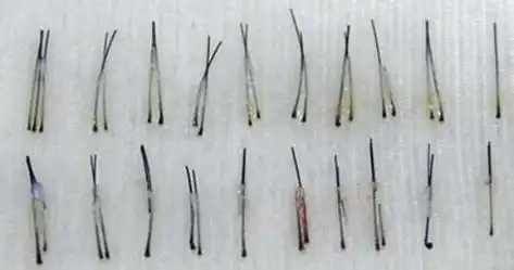 关于种植出来的头发能够保持多久,上面也提到了,成活之后的毛囊跟我们