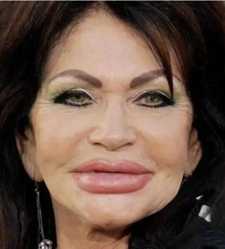 吓cry!盘点最失败的整容手术(8)