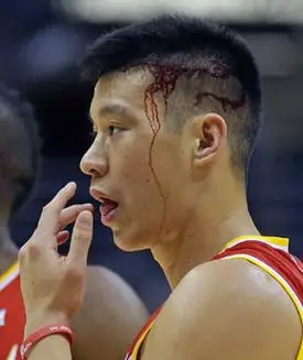 组图:火箭vs雄鹿 林书豪脑袋流血