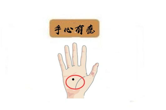 手心有痣若是一个男人的手心长痣,说明这是一定好运的说法,这种人必定