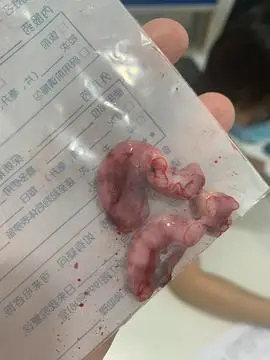 求助六个月小母猫绝育取出来的子宫这样是正常的吗求大家帮忙看看