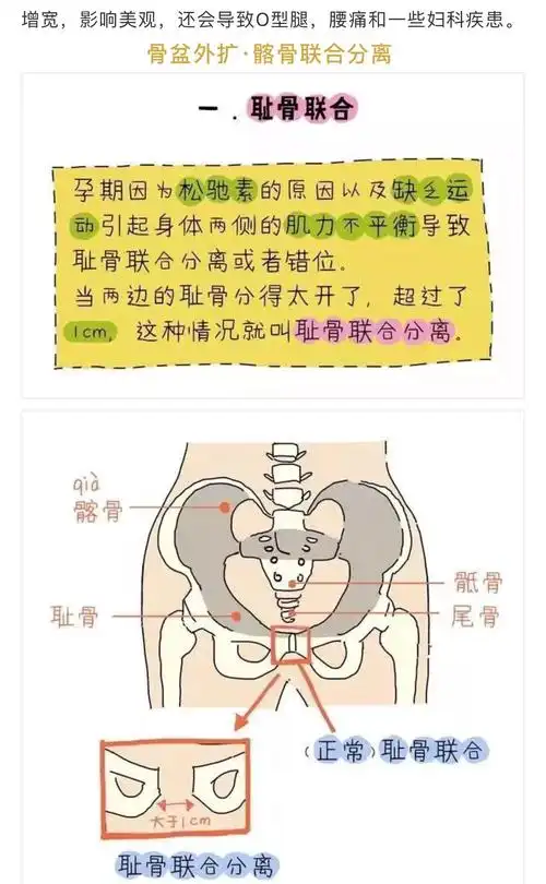 生完孩子为什么要做骨盆修复,别不当回事