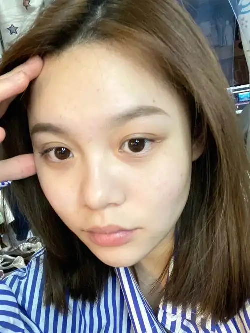 近期的皮肤状态