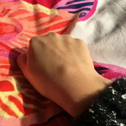 右手手背上有一个囊性结节,可以用艾灸治疗吗?