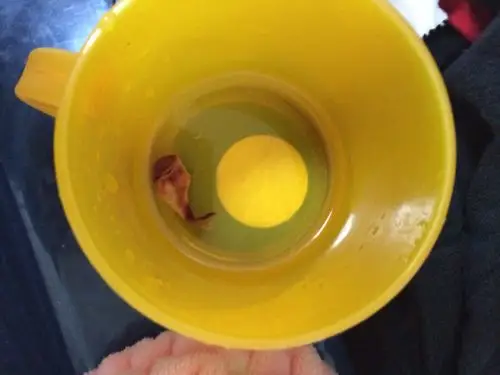 请问 自然流产流出这样的胚胎 这应该是多少天的样子