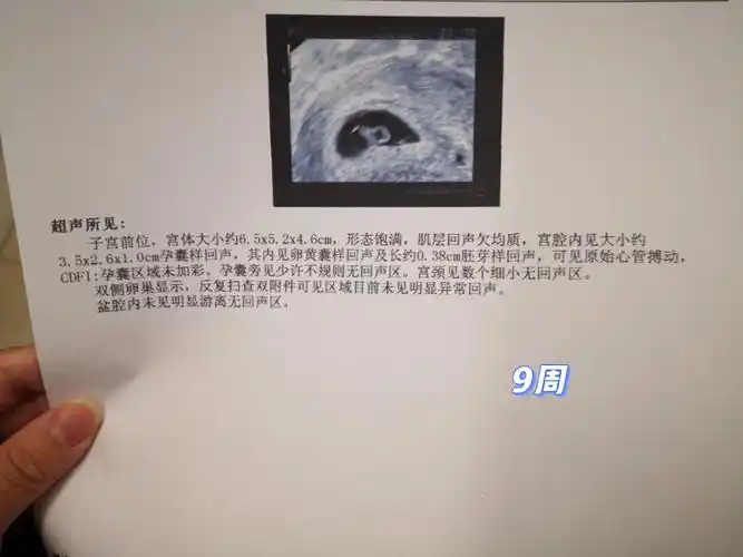 9周终于见到胎心胎芽了(实际6周大小唉)