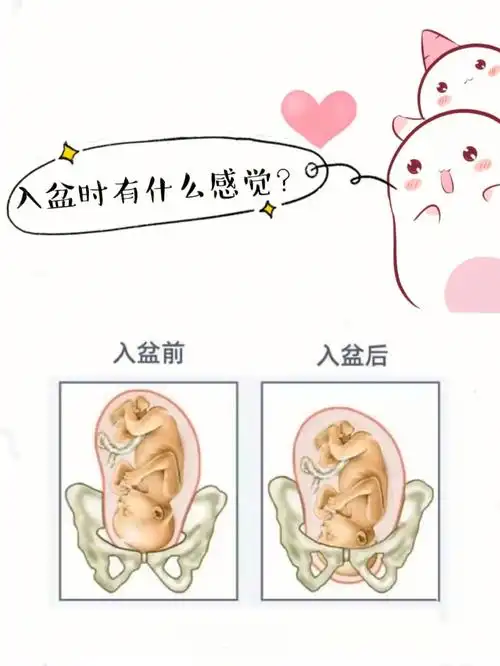 胎儿入盆6大信号75早入盆晚入盆有影响吗?