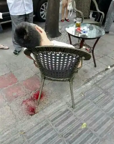 一男子头部中枪(该案已告破)