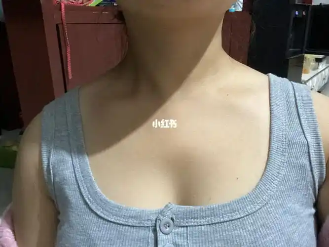 斜方肌还有救吗