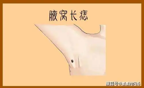 身体6大暴富痣,财神爷关爱,中年飞黄腾达,个个腰缠万贯