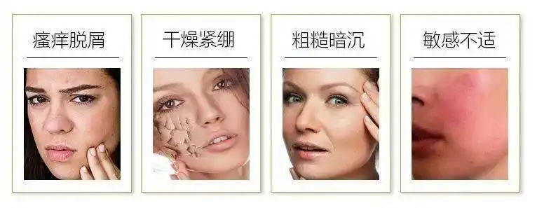 戴口罩引起的肌肤问题