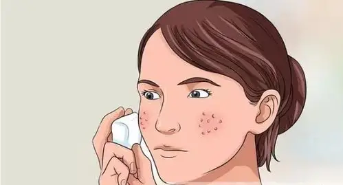 无花护肤小知识毛孔粗大分4类教你如何对症下药