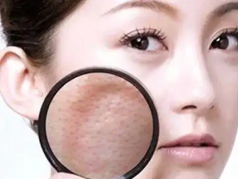 脸上去角质有什么好处去角质三大误区