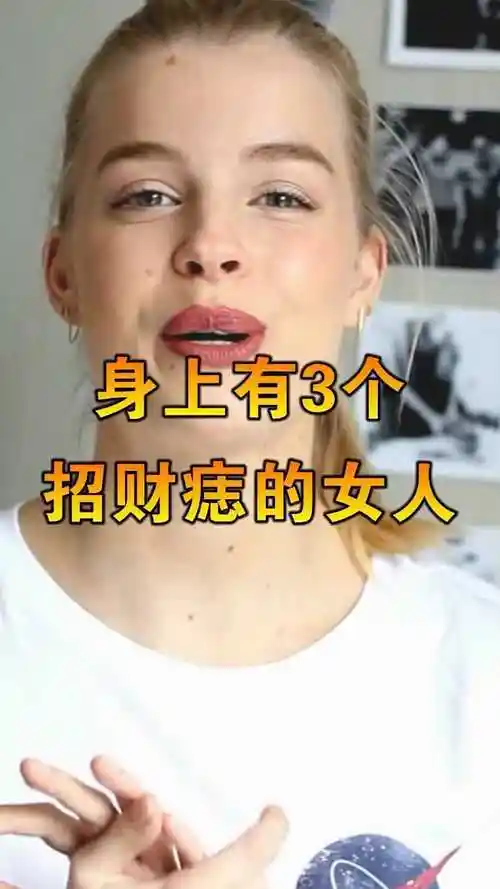 女生这三个地方张痣天生老板娘命福泽深厚