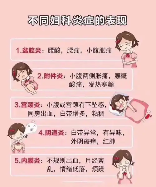 宋阳教授介绍妇科炎症的常见症状有哪些