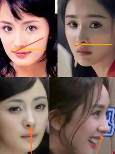 杨幂逆天改命是靠整容还是拔牙将大方脸变成小v脸的