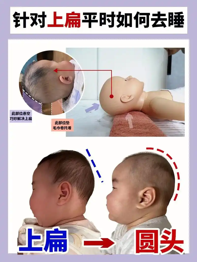 创作灵感 睡圆头|这样教你调整上扁头型73该会了吧75#圆头和