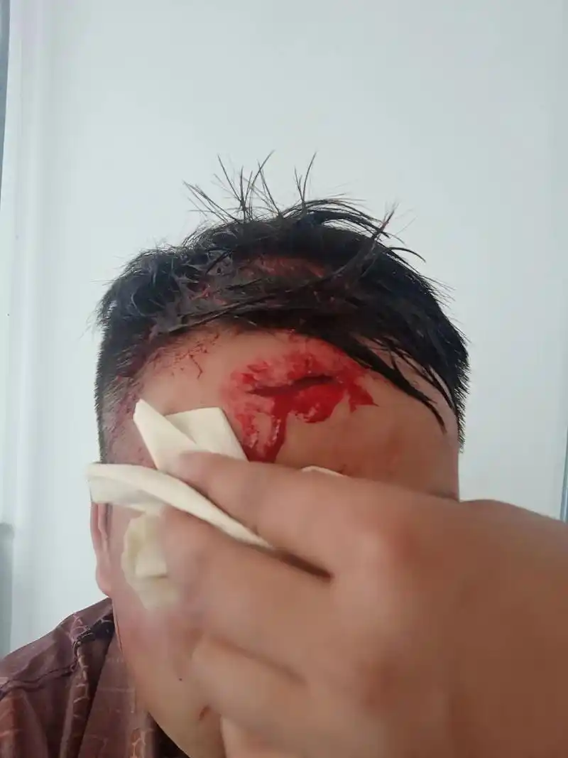 才两天就恢复得这么好,明天可以上班了哦,发个作品出来,让关系 - 抖音