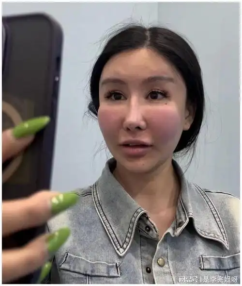 金美娜分享再次整容|演员|微整|避雷_网易订阅