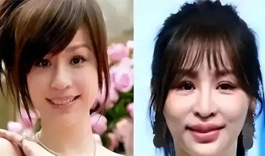 沉迷整容的4位女明星,有的"逆天改命"爆红,有的断送大好前程