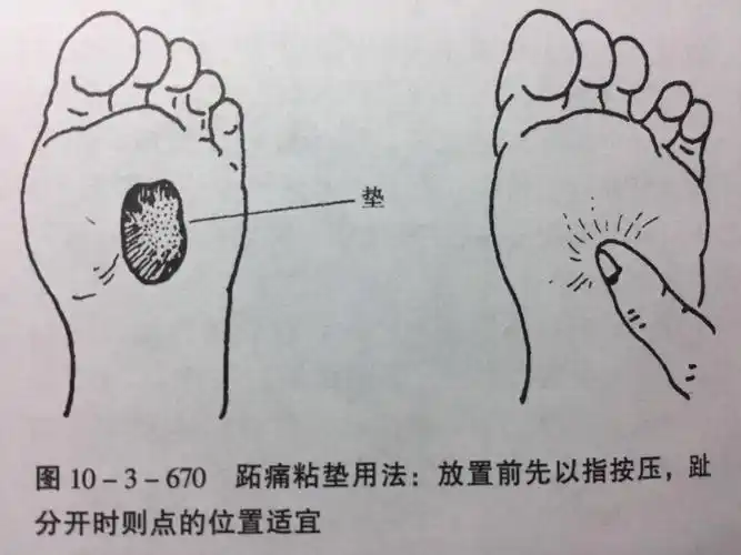 前脚掌疼痛_疼痛_介绍_缓解方法 - 好大夫在线