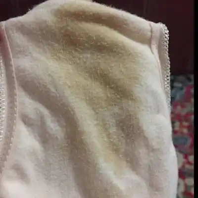 怀孕356天,内裤上每天湿湿的,还发黄有一股尿骚味,腥味很重,好尴尬.