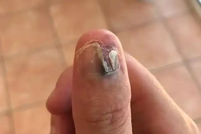 与朱一龙同样爱啃指甲的孩子,成长中的坏处要留心,早阻止早避错